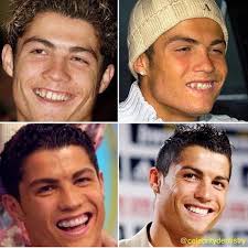 Nun werden gerüchte laut, das paar erwarte zwillinge. Dentalchat On Instagram Dentistry Is A Beautiful Thing The Progression Of Cristiano Ronaldo S Smile By Celebritydentistry Dentistry Dentist Dentalassis