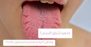 او المغناطيس البشري الملقب بالزوهري هل هو من. ØªØ´Ù‚Ù‚ Ø§Ù„Ù„Ø³Ø§Ù† Ø¥Ù„ÙŠÙƒ ÙƒØ§ÙØ© Ø§Ù„ØªÙØ§ØµÙŠÙ„ Ø¹Ù†Ù‡ ÙˆÙŠØ¨ Ø·Ø¨