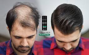 Buy Thick Fiber- Hair Building Fibers