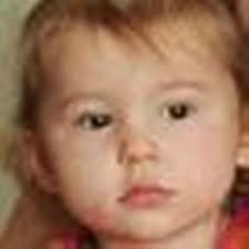 Mum tells of meningitis horror which cost daughter all of her limbs