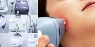 بعد جلسة الليزر الاولى للوجه أو للبكيني تستخدم عملية إزالة الشعر بالليزر من أجل تقليل ا laser hair removal best laser hair removal best hair removal products