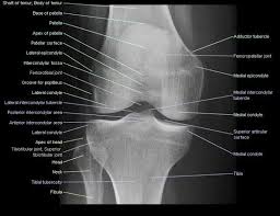 Image result for Knee XRay