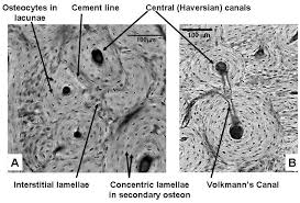 10 Concentric And Interstitial Lamellar Bone Transverse Section Ovine Download Scientific Diagram