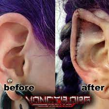 Body modification (or body alteration) is the deliberate altering of the human anatomy or human physical appearance. Would Surgeons Agree To Ear Pointing And Sculpting Photo