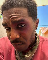 my character got slept 👊🏾💥😭 y'all see my eye?? 😩 . . . #actor  #actorlife #setlife #losangelesactor #workingactor #casting  #actorsofinstagram #castingdirectors #sagaftra #stuntman #actorslife🎬  #actorsaccess #onset