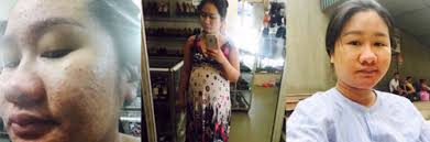 Sau sinh: Nỗi lòng bà mẹ hotgirl bỗng xấu tột độ vì mang bầu đang được  nghìn người chia sẻ