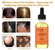 For curly hair, they help define curl patterns. Buy Elhujaj Natural Hair Growth Oil Hair Loss Treatment Hair Growth Serum Castor Oil Nine Effective Oils To Regrow Longer Thicker Hair For Men And Women Online In Indonesia B08p7yg358