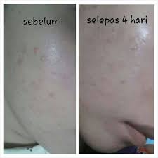 Nak beli loose item atau set pun boleh dgn harga promosi. Testimoni Ajaib Sabun Collagen Nurraysa Nurraysa Beauty Network