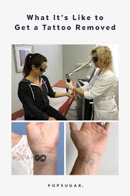Ownership comes with tools that make running a business simple, so you're free to spend your time doing what you do best: What It S Like To Have A Tattoo Removed Popsugar Beauty