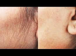 If you want to get rid of facial hair, then go for natural methods for it. Remove Hair Permanently At Home Natural Diy Face Upper Lip Superwowstyle Youtube