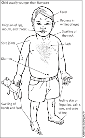 Kawasaki Disease What You Should Know American Family Physician