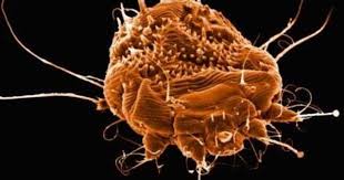 Occupy Denver Infested With Scabies Scabies Home Remedies For Scabies Mites