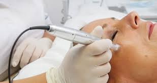 We did not find results for: Micro Needling How Often Should You Do It