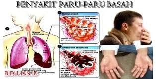 Pin Di Terbaru