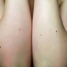 Here S What Happened When I Bleached My Body Hair At Home Body Hair Bleach Bleach Arm Hair How To Lighten Hair