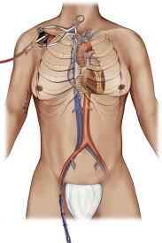 A full 104/105 keycap set enables you to upgrade your full keyboard. 2020 Eacts Elso Sts Aats Expert Consensus On Post Cardiotomy Extracorporeal Life Support In Adult Patients The Journal Of Thoracic And Cardiovascular Surgery