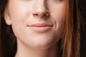 Bell's palsy is temporary weakness or lack of movement affecting 1 side of the face. Nonflaccid Bell S Palsy In Lyme Disease Daniel Cameron Md Mph