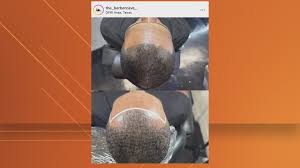What is scalp micropigmentation? Texas barbershop owner, client speak