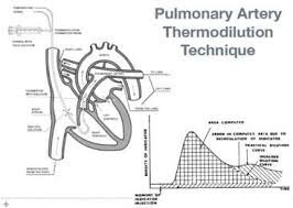 Pulmonary Artery Catheter Litfl Ccc Equipment