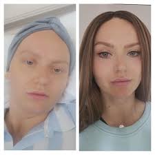 Glasgow beautician's miscarriage helped medics find breast cancer.