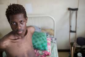 Tuberculosis, untreated, can be rapidly fatal in aids patients. Png Under Strain To Tackle Drug Resistant Tuberculosis Australia Network News Abc News Australian Broadcasting Corporation