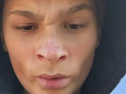 Fundraiser for Sondra Drahos by Kim Sebastian Criscuolo : Help Dexter beat  leukemia