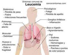 La leucemia mieloide acuta (lma) è un tumore del sangue che comincia nel midollo osseo. Enfermedades