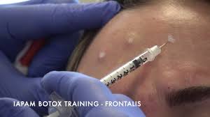 Accordingly, recommended dosing varies considerably between injection sites and procedures. Botox Training Injecting Frontalis Youtube