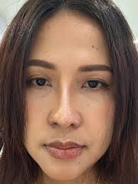 best doctor? plan kopo pa rhino by november can't decide if Kosmed, Dc lao,  Dc Christian.