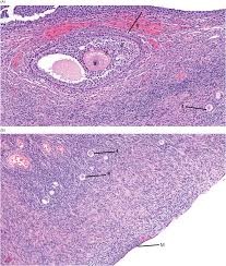 Structure of mesothelium diagram figure 4. Mesothelium An Overview Sciencedirect Topics