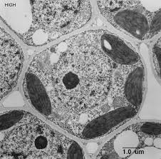 Animal cells possess centrioles whereas plant cells lack centrioles. Tem Of Plant Cell