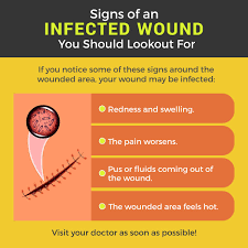 Signs Of An Infected Wound You Should Lookout For Signs Infection Diy Treatment Home Health Care Wound Care