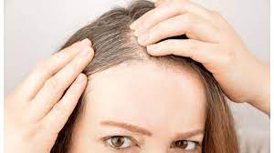 It's a natural hair shedding process. Hair Loss With White Bulb Immer Organic Hair Expert