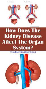 Pin On What Is Kidney Disease