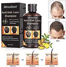 Biotin Shampoo Before And After Men Pin By Noor Raahim On Naseer Products In 2020 Anti Hair Loss Shampoo Anti Hair Loss Hair Loss Shampoo