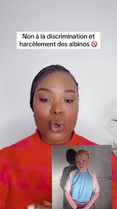 Non à la discrimination des albinos : Lutter ensemble