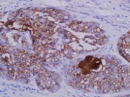 This reduces the risk of market timing and can potentially lower your. Medac Diagnostika Protein And Nucleic Acid Detection Western Blotting Bcip Nbt 1 Component Phosphatase Substrate 6 X 100 Ml Reference 5420 0033