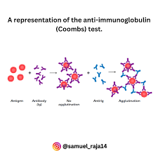 Image result for Coombs
