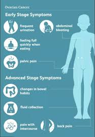 Signs and symptoms of ovarian cancer may include: Sanjeevani Cbcc Usa Cancer Hospital Raipur