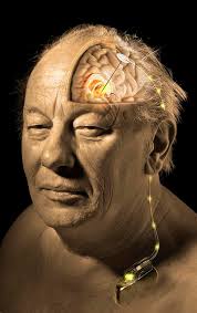 Deep Brain Stimulation, Artwork by Science Photo Library