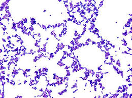 Pick from a variety of distinct digital and compound trinocular fluorescent microscope at alibaba.com for research and studies. Pin On Bacteriology