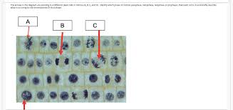 The mitotic spindle is staring to from. Solved The Arrows In The Diagram Are Pointing To 4 Differ Chegg Com