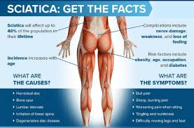 Then you get home, and you sit down at the table to have some dinner as your sofa is calling you from the living room. Sciatica Why Does My Back Problem Cause Such Severe Pain Down The Back Of My Leg Physiofit Physical Therapy Wellness