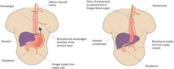 Be sure to call ahead with dr. Oesophageal Cancer And The Anaesthetist Bja Education