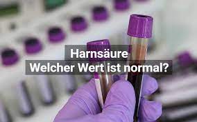 Harnsaure Spiegel Laborwert Einfach Erklart Praktischarzt