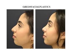 Profile for Been Facial Plastics