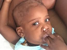 Fundraiser by Marie Francois : Jada's Kidney Transplant/Treatments