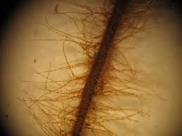 Image result for Triplophyllum