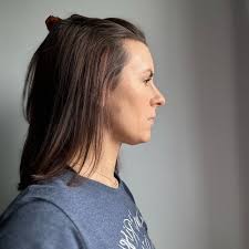 TOP 10 BEST Trichologist in Glendale, AZ