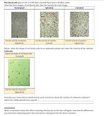 Jul 04, 2020 · 3) blood cells: Red Blood Cells Placed Into In 0 9 Nacl And 10 Nacl Chegg Com